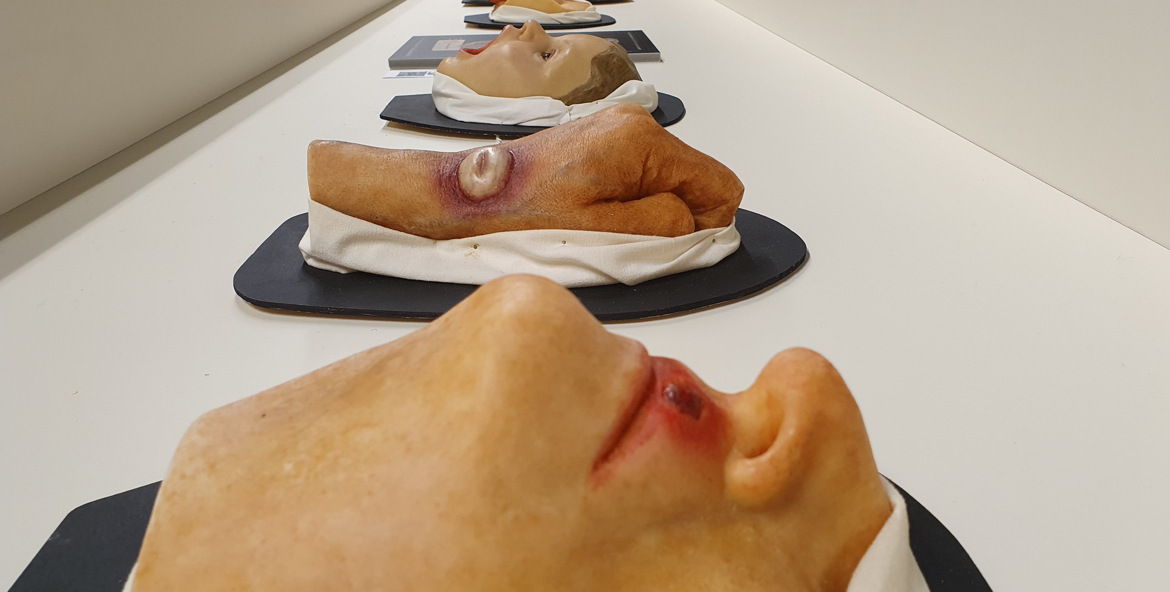 Moulagen_Infektionskrankheiten_MHS_RUB.jpg