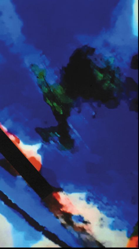 HANS ALVESEN – Ausstellung in der Torhausgalerie des Botanischen Gartens